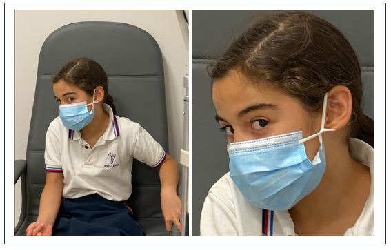 Nistagmus